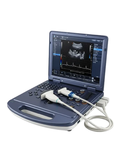 3D/4D Color Doppler Ultrasound Machine with Convex & Linear Probes, view 1