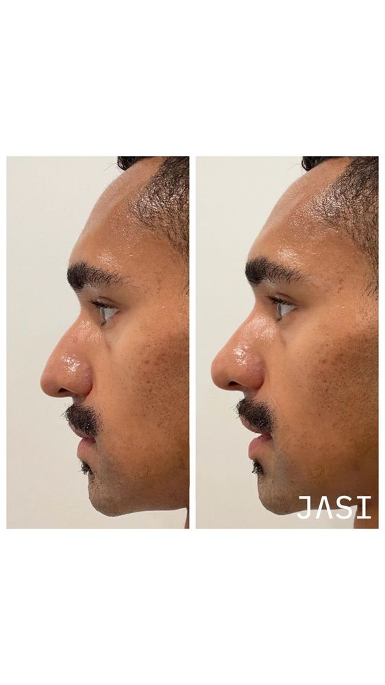 JASI Skin + Wellness Med Spa photo 5