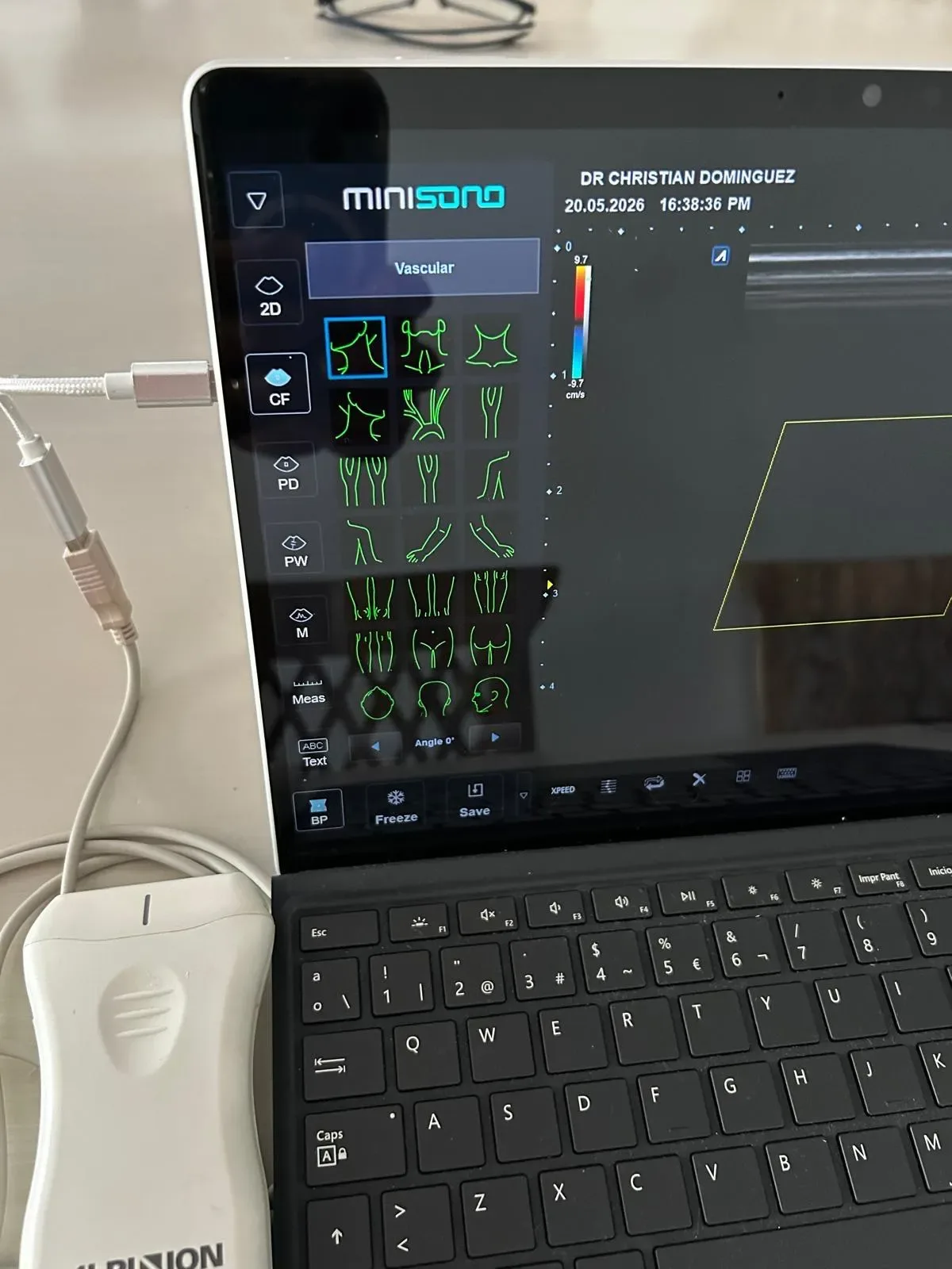 Miniatura 7