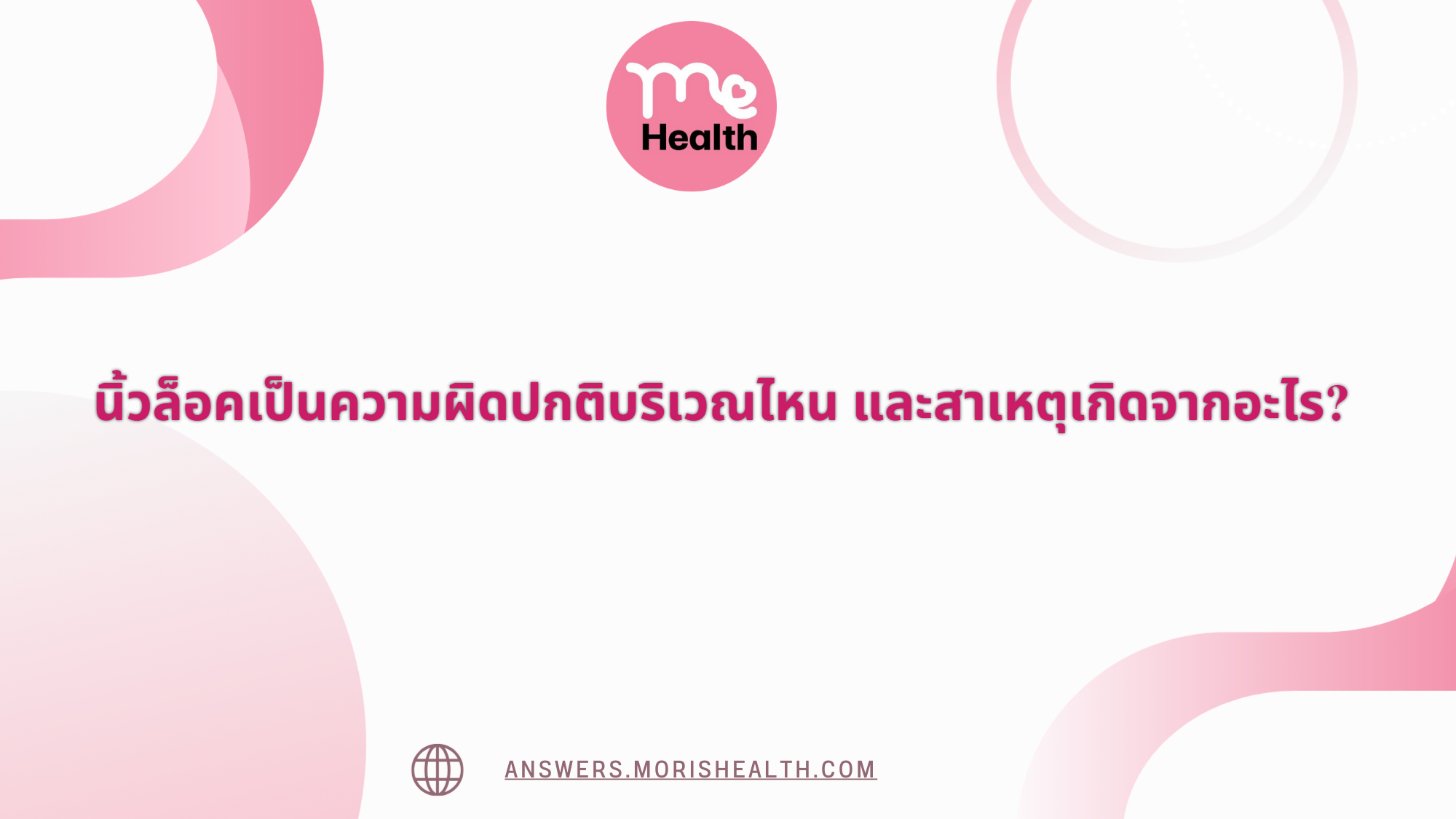 นิ้วล็อคเป็นความผิดปกติบริเวณไหน และสาเหตุเกิดจากอะไร? 