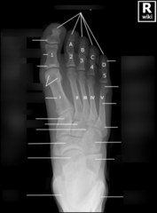 AP Foot anatomy