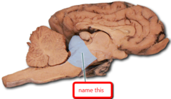 Sheep Brain Identification