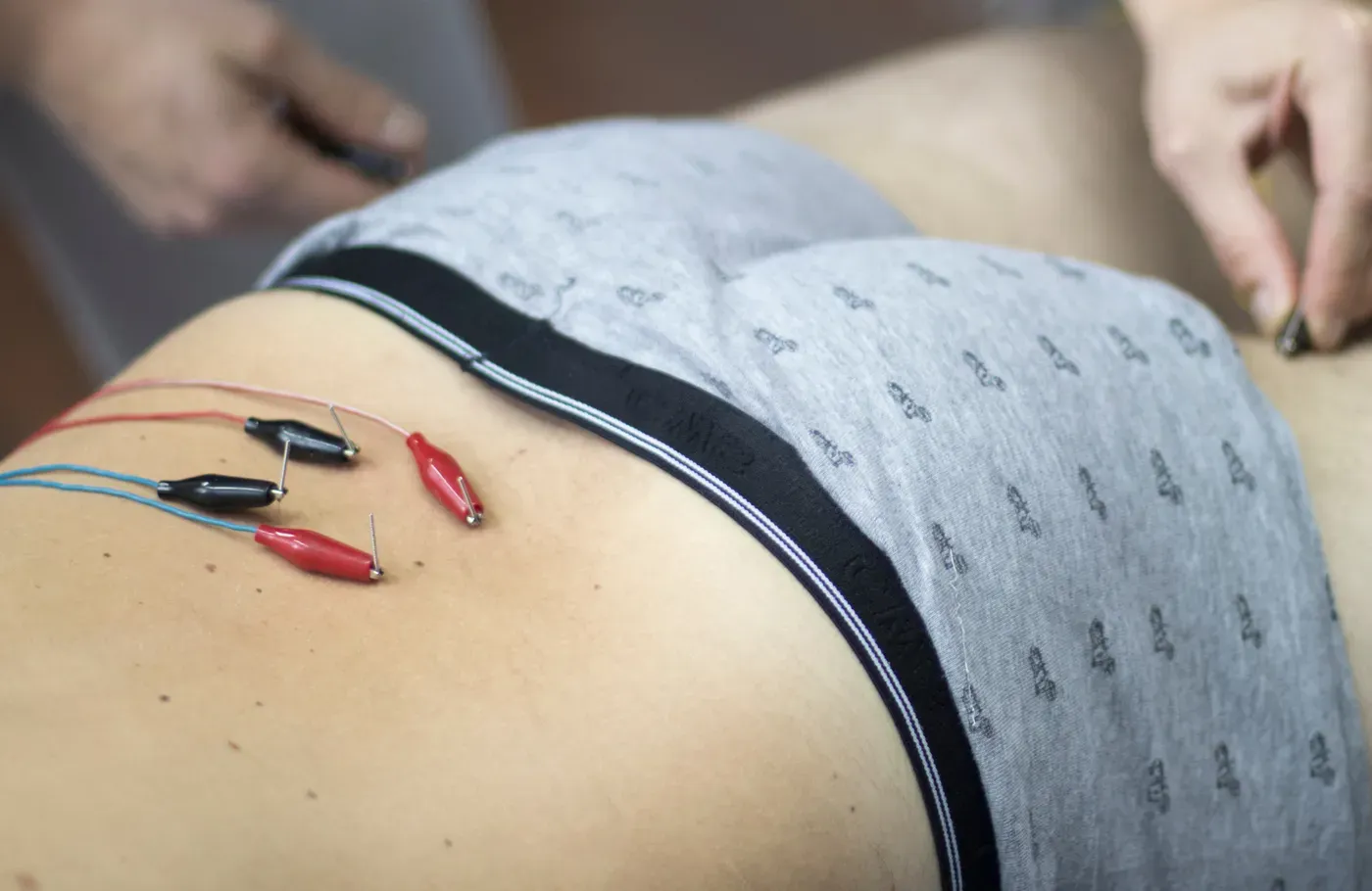 Imagen del curso: Síndrome de Dolor Miofascial en Suelo Pélvico: Punción Seca y Tratamiento Conservador