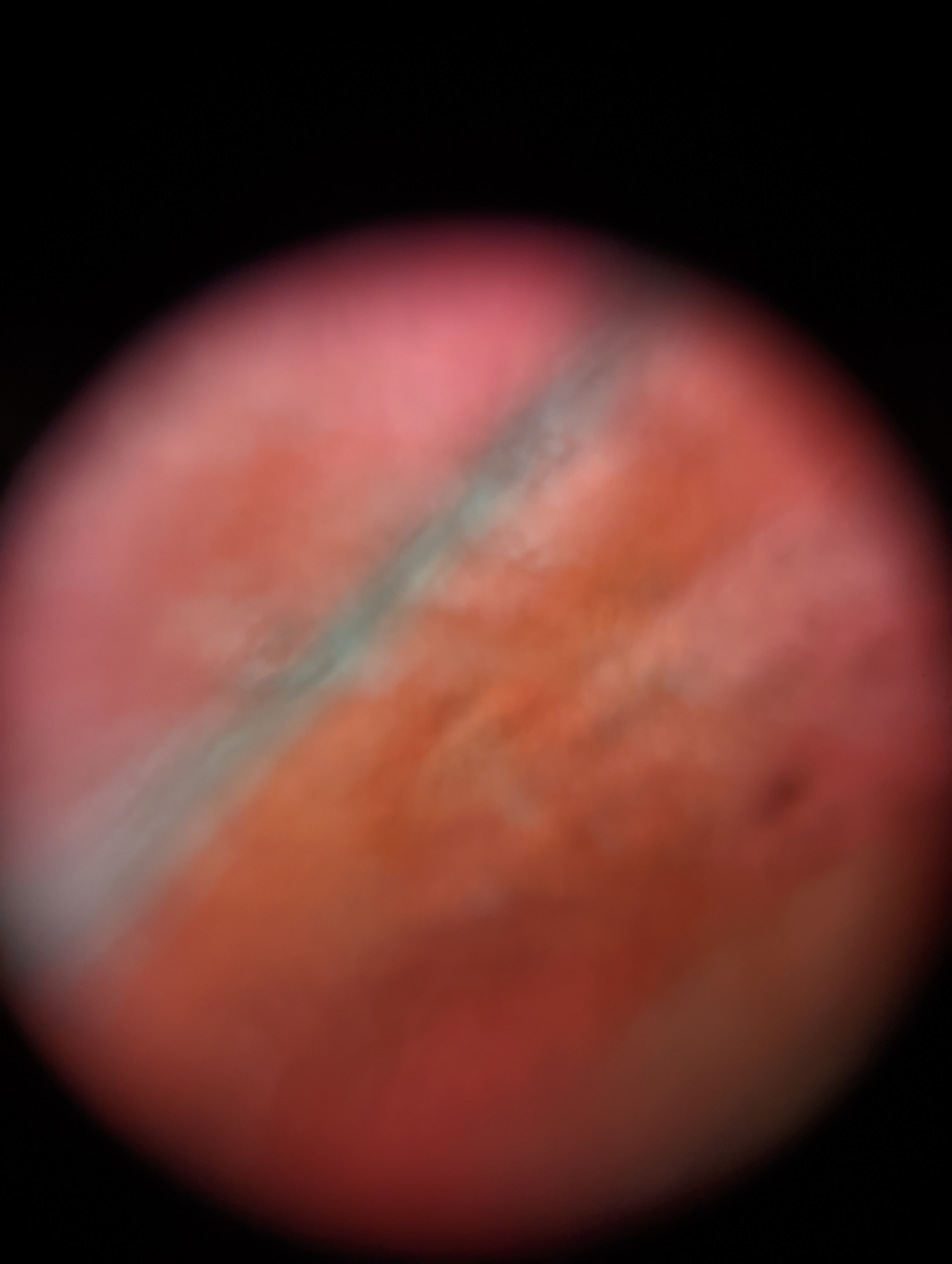 NaN%2FPXL_20221204_200404219.jpg?alt=media&token=c2dda7ad-09f5-4119-90df-2122a22c73df