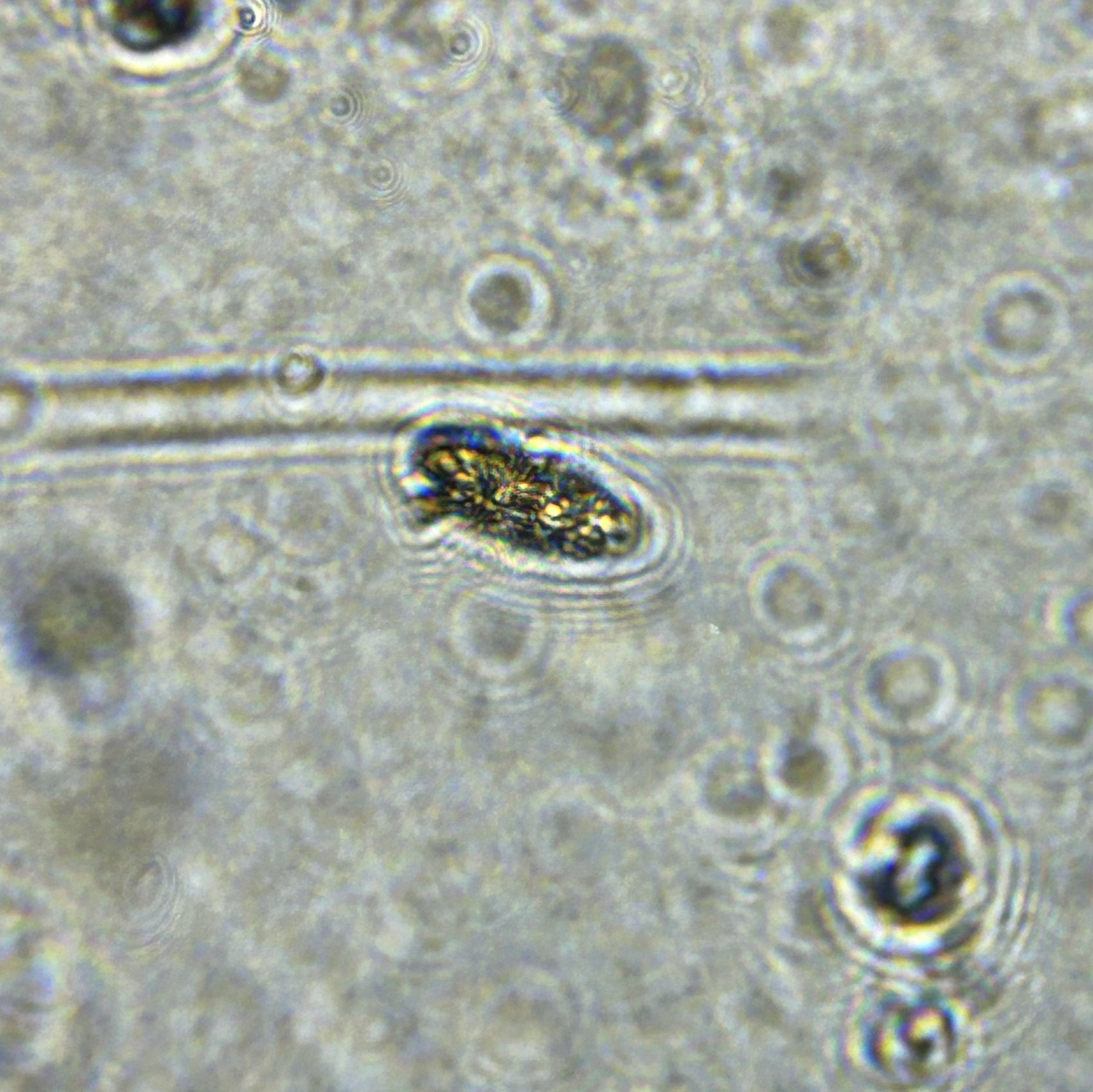 images%2F41701003-7c8d-4345-90c2-fea1c24b3f9f%2F9938d223-0e48-435b-8a2b-a6fc94ae559d.jpg?alt=media&token=afb3197b-ae2e-41cc-8e20-056d423d83a1