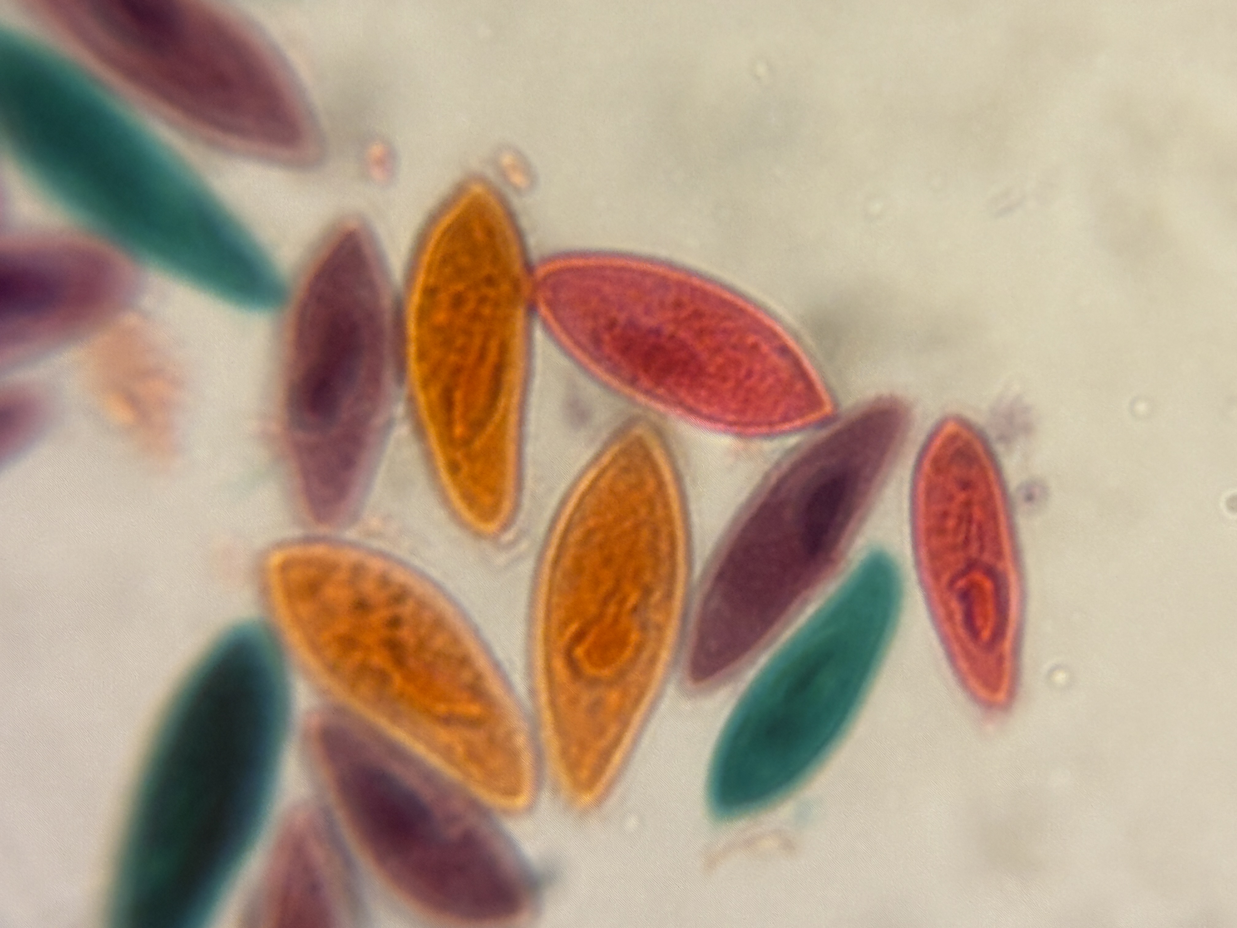 images%2F8Yi896oa53USpBdodktyyatmY943%2F8ey4EwcARFBYRvV39SVh%2F0fe8ad9d-3472-4624-abb4-75e95c90374d.jpg?alt=media&token=54c53dee-5bf5-47ca-9581-4c37c06445b8