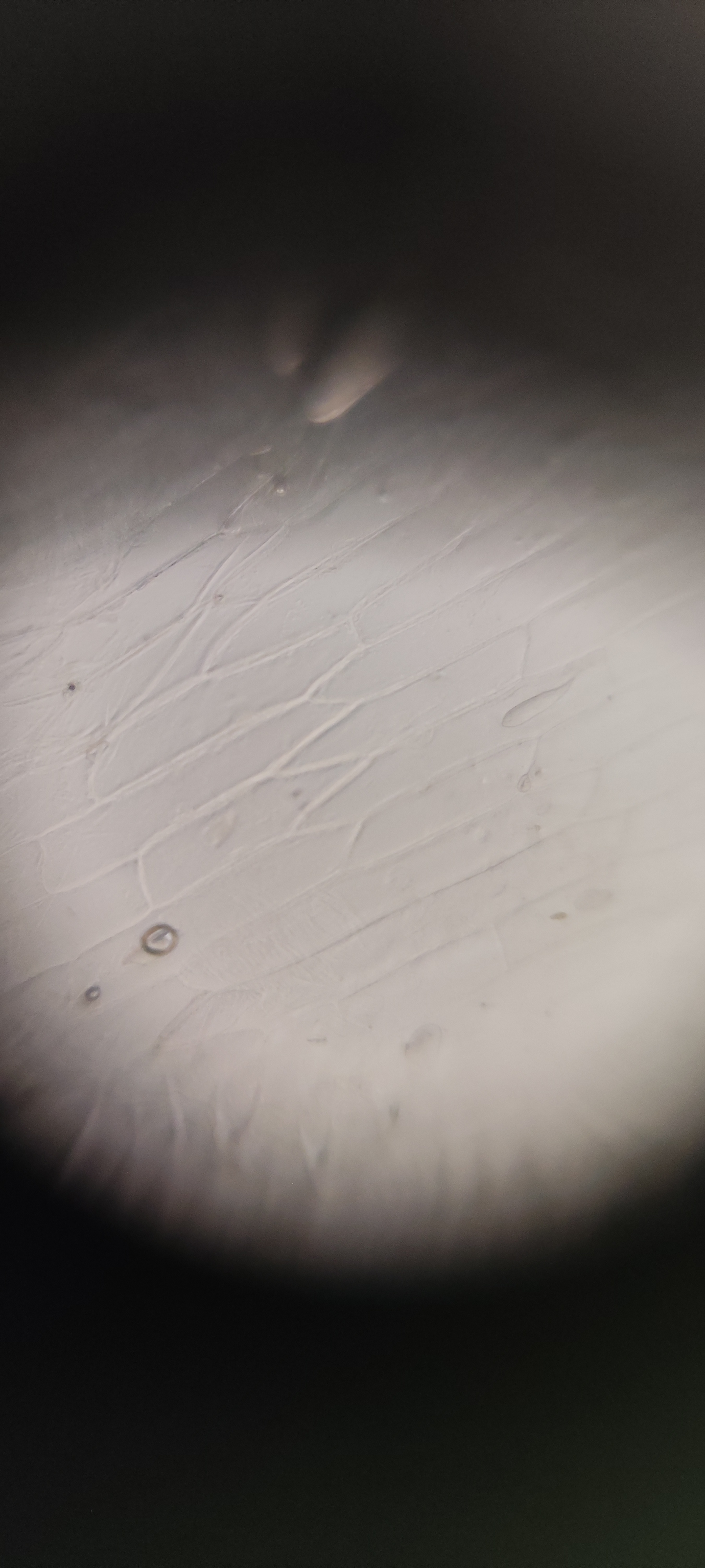 post_media%2F36Lg6k5SZYcF3RDFWlf1yKRaAcG3%2Fnopid%2F4t6pskjfbg_IMG_20250808_113028.jpg?alt=media&token=c944d538-de8a-4175-9a3e-f175c4d70453