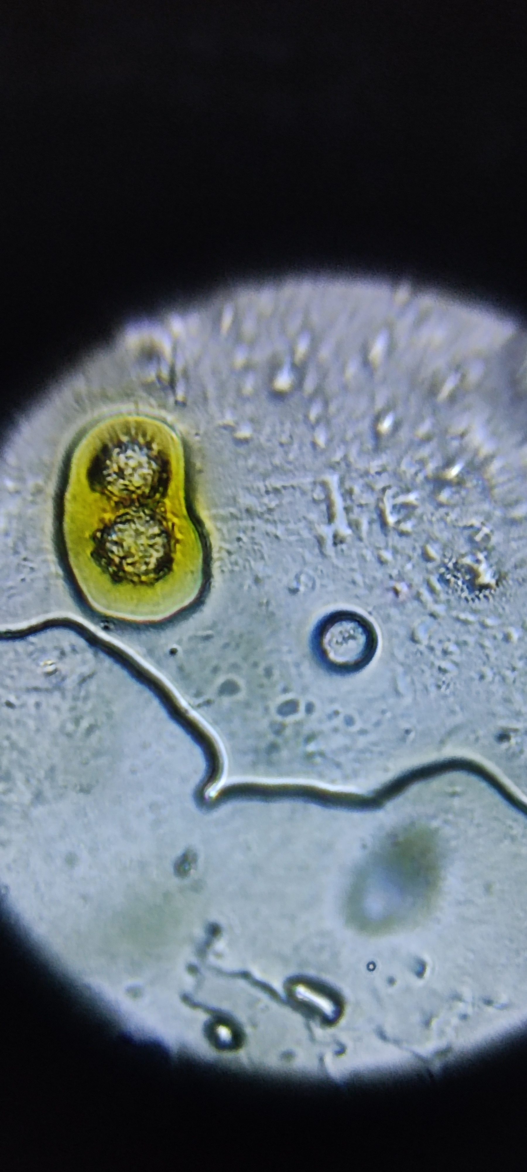 post_media%2F36Lg6k5SZYcF3RDFWlf1yKRaAcG3%2Fnopid%2Fc67ue0aujv_IMG_20250914_162139.jpg?alt=media&token=cfb4192b-db69-4bfa-bb76-37a18a75a231