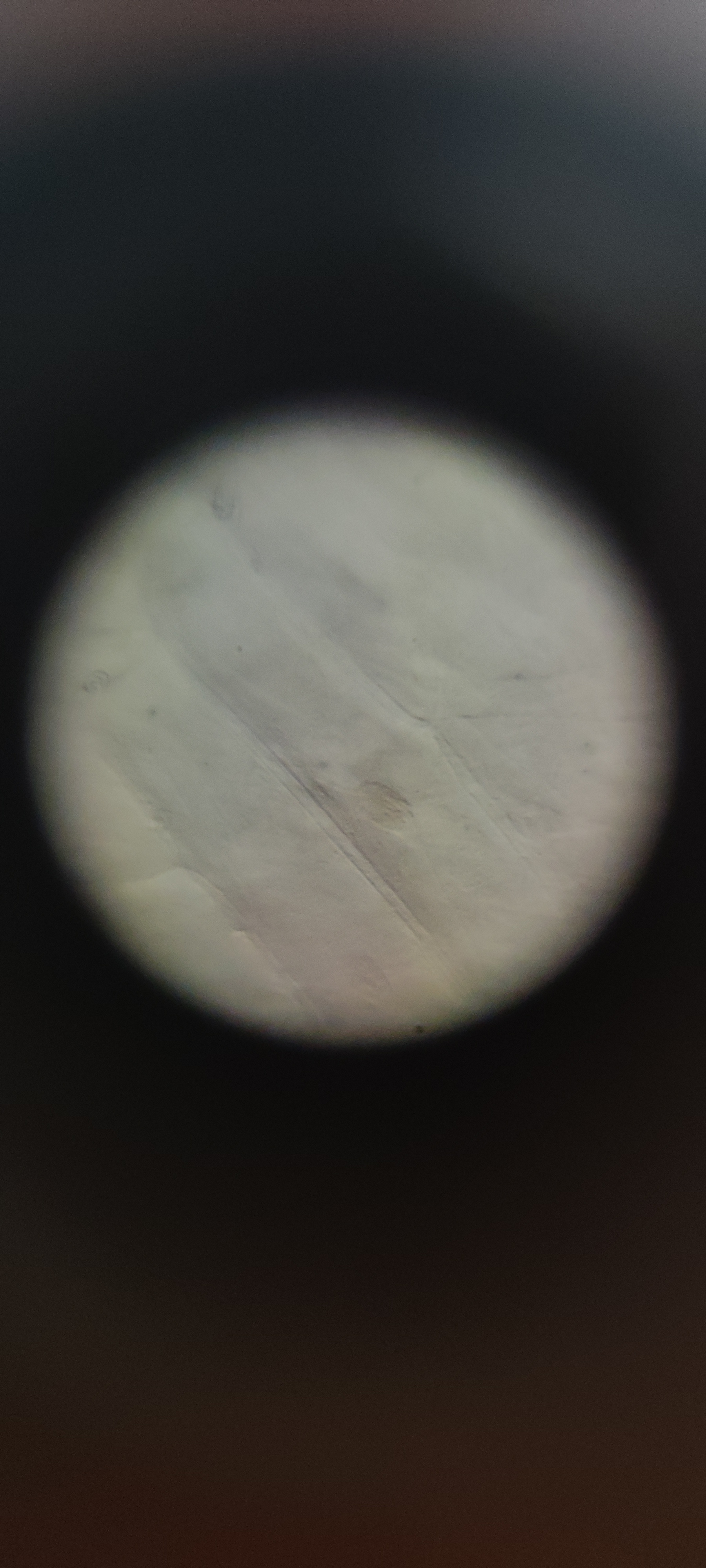 post_media%2F36Lg6k5SZYcF3RDFWlf1yKRaAcG3%2Fnopid%2Fyt420jjcfi_IMG_20250808_114004.jpg?alt=media&token=7332ef38-8d45-46d1-8e92-ed5220aab7f7