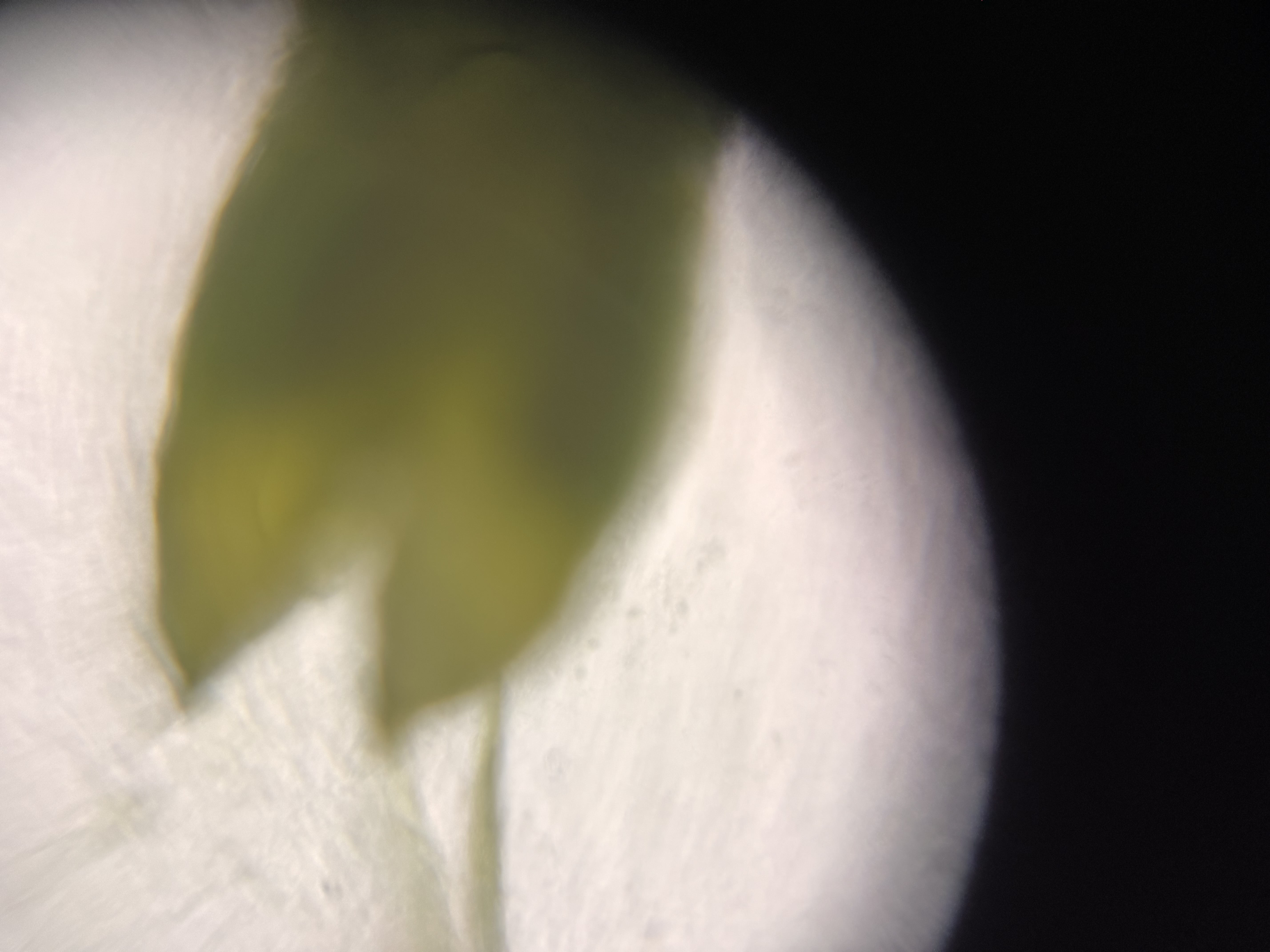 post_media%2F4SsNqxnlIvR5WtM727uuLmKPTJE3%2Fnopid%2F6xeobvwz41_IMG_3050.jpeg?alt=media&token=44d92a86-aa3c-4e8b-a248-0465ff6ff483