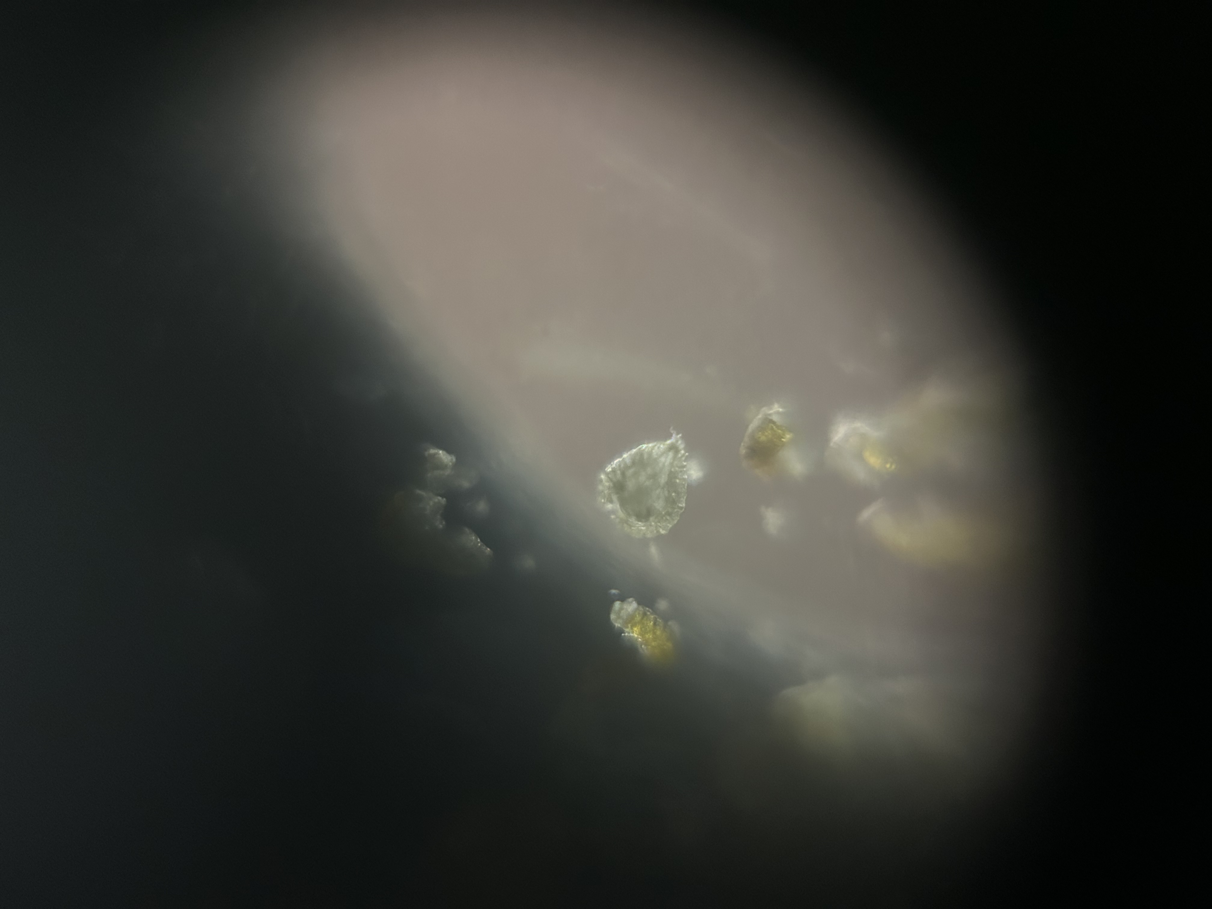 post_media%2F51dVb7kKksYgExdlWK4ZTlO5Fqv2%2FDissxMj3a4nrmvfJ5w56%2Fvzgkaidmx0_one%20spore.jpeg?alt=media&token=18fc011b-3e41-4ecc-94a6-9cac904086f6