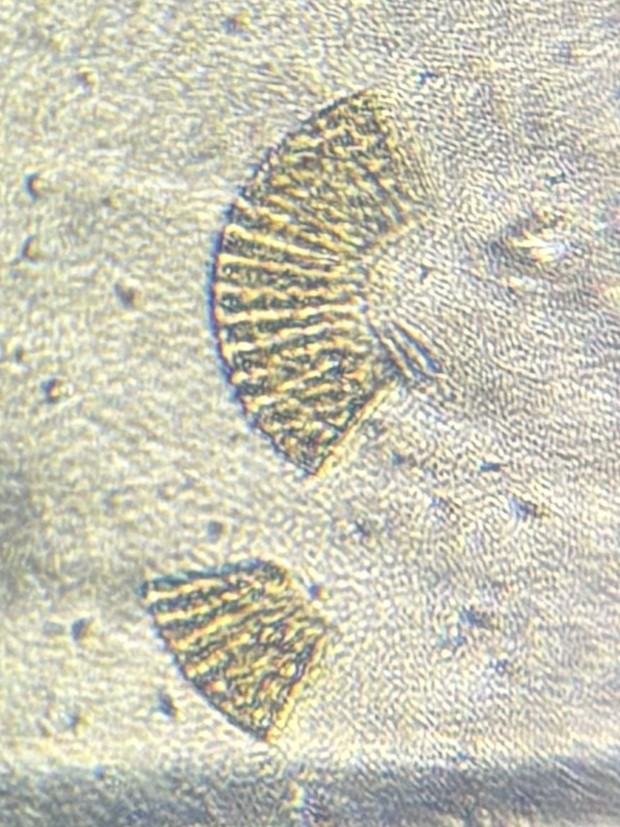 post_media%2F5k6WZbVUKUfKnmVnClqozYAwYFy2%2FJhqSKPmnc8dXrYT1NOtC%2Fxhue1jmyyp_IMG_7488%20zoom%20of%20partial%20cell.jpeg?alt=media&token=2d22711b-69b4-44b5-9f1c-a26785490184