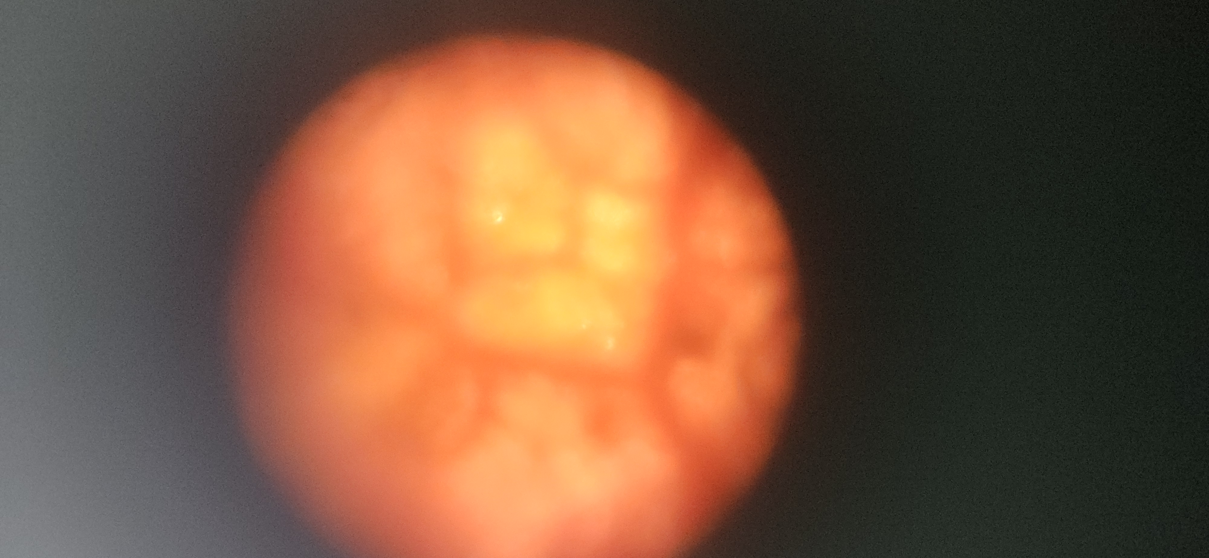 post_media%2F9oh13g6BQkfDUwX8VoI8tevl1cI3%2Fnopid%2Fc76awrd7ov_1000014469.jpg?alt=media&token=13c4428c-2c51-4844-9a45-98f323bd7421