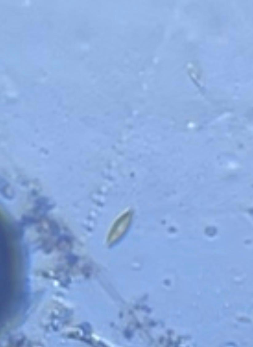 post_media%2FA1bYOTJG0mPsaBXeOyI01BinmtX2%2Fnopid%2F3r7tkxjvqq_4.jpeg?alt=media&token=398e09a1-924a-49a7-9a72-aa0d5aec4d33