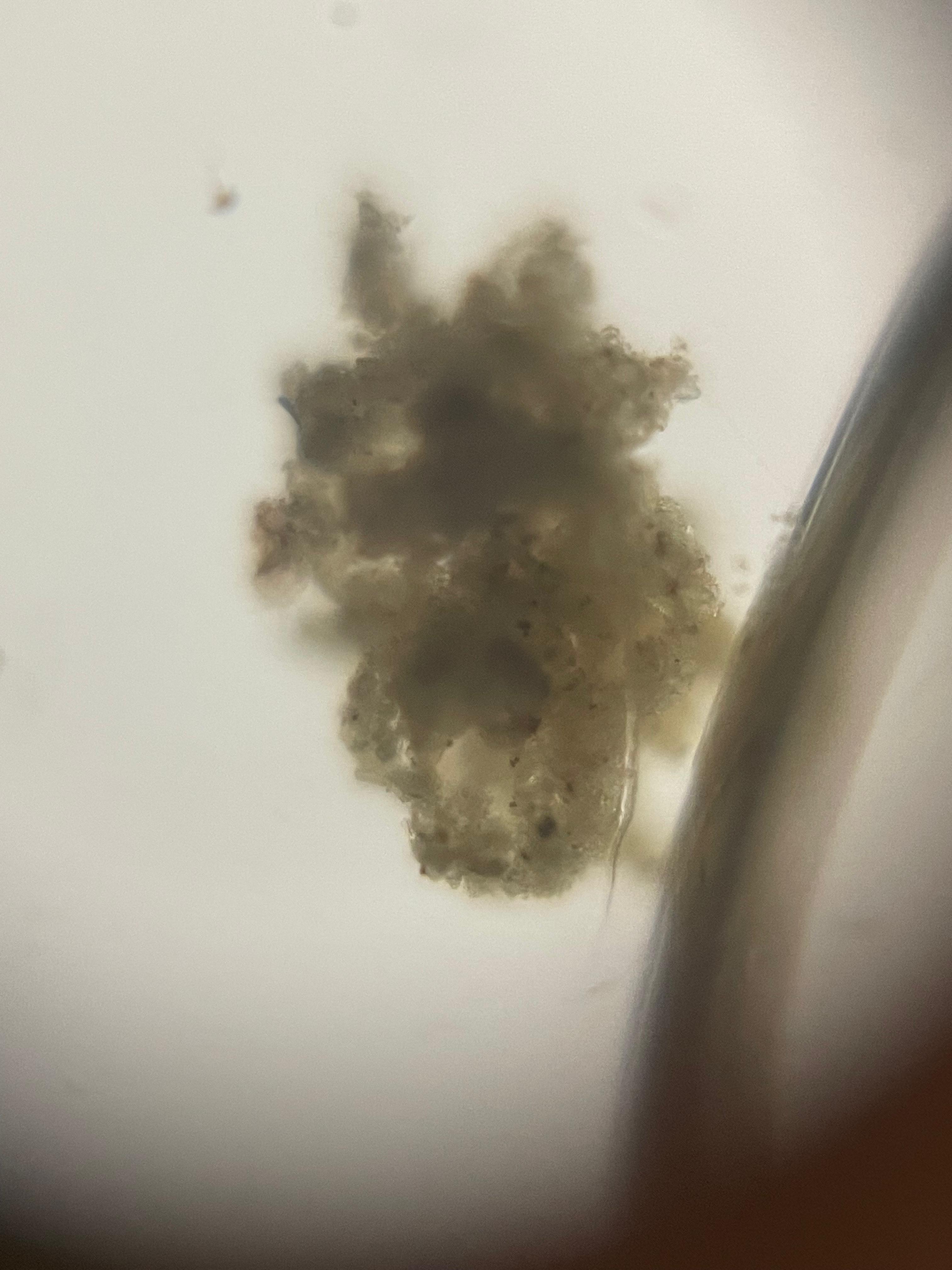 post_media%2FA1bYOTJG0mPsaBXeOyI01BinmtX2%2Fnopid%2Ftj2gbkhn35_ma.jpeg?alt=media&token=5f0bcd57-2a7e-41bf-8abc-a2be6d27697d