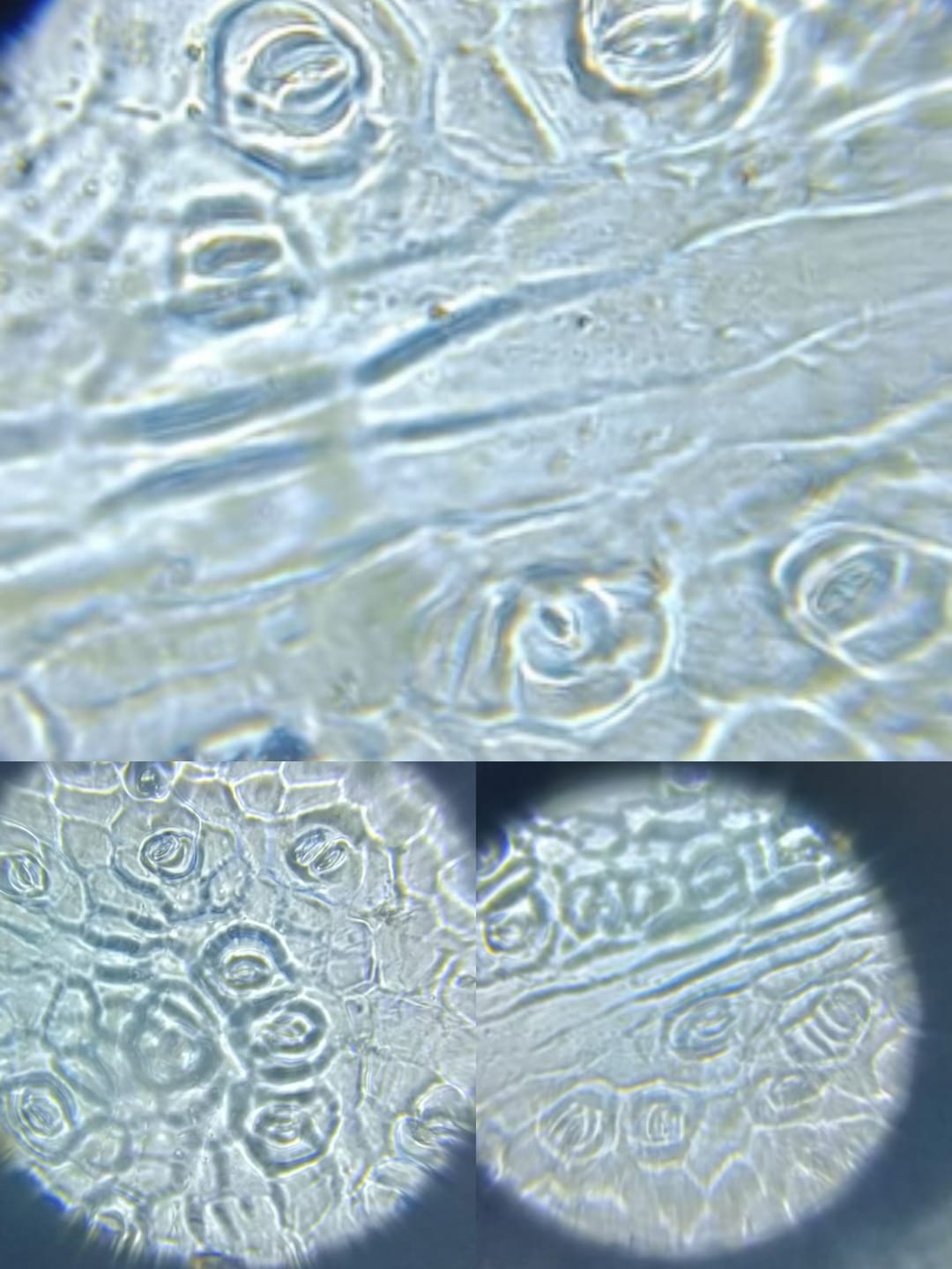 post_media%2FGM4YGEP2CBbL6oRtOBVFYFLRob32%2Fnopid%2Fp23jxnpmrd_stomata2.jpeg?alt=media&token=1a05e8f6-0b7c-4455-87d6-58aee1e08048