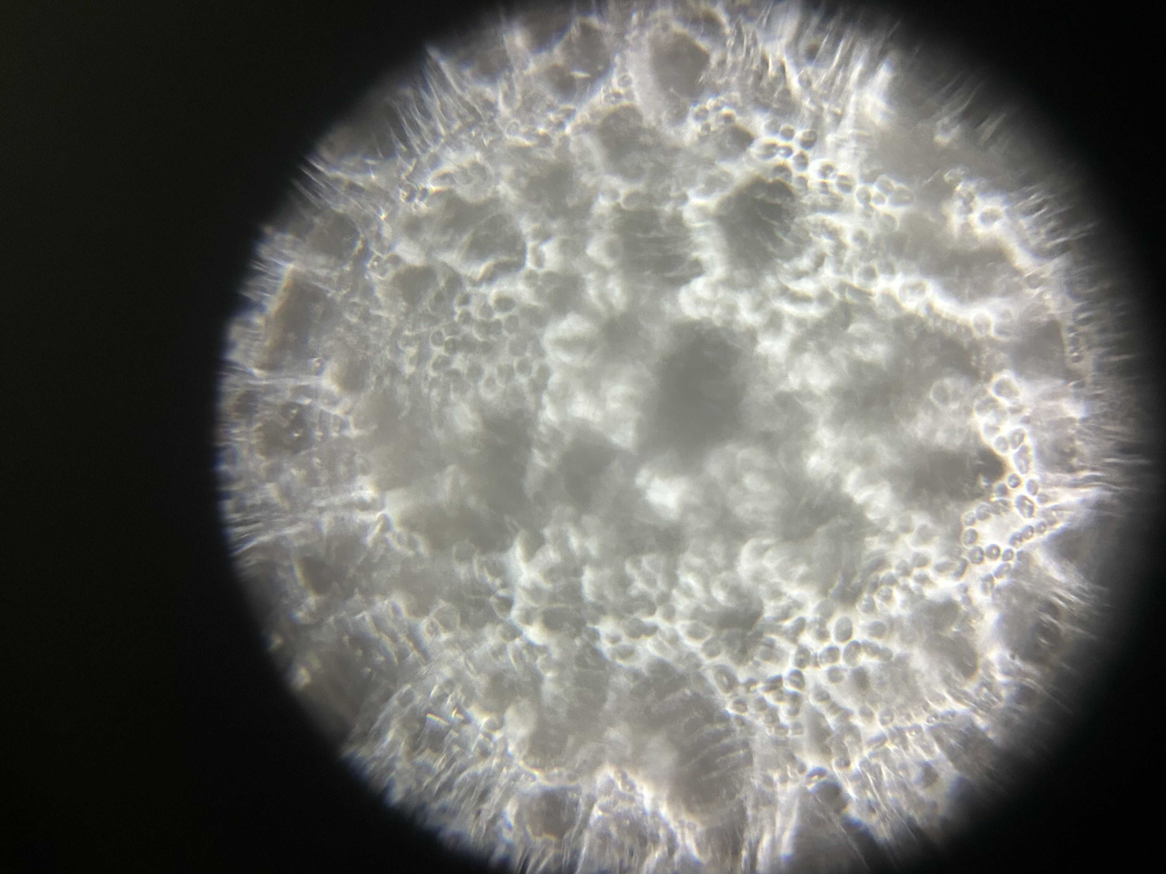 post_media%2FHrk0G2SEiCb2Z3XifjOhzr4uYQ62%2Fnopid%2Fh6e6urs2td_IMG_6759.jpeg?alt=media&token=94042fe7-468c-4aaf-bd47-14acb4a8d050