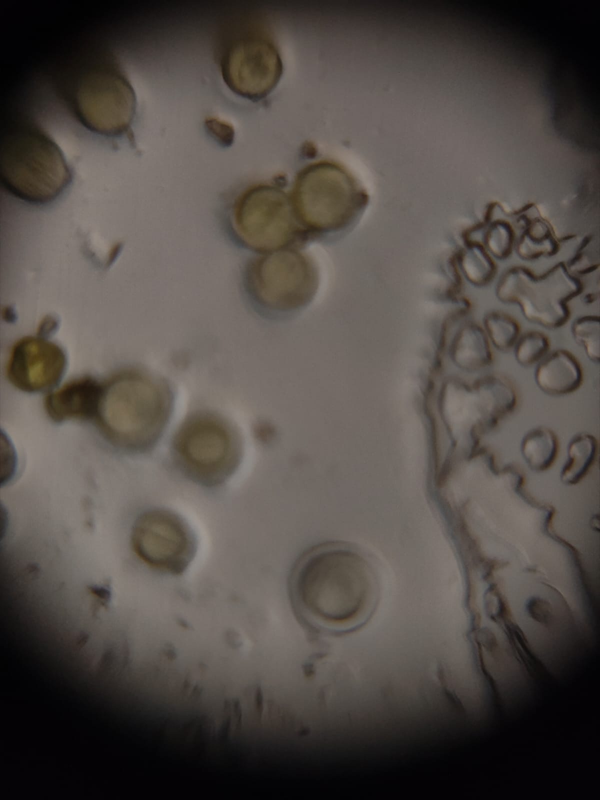 post_media%2FPZVpiRCVUYdNj0QoASz3PHcKfdi2%2Fnopid%2Fsare268j6w_PF%20Pollen%20140x.jpeg?alt=media&token=2128242e-51b3-4835-94a6-3760db69feb4