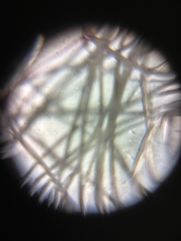 post_media%2FS1FZPd3fuZX1TeFGnPSrBkV7QCp2%2Fnmf1BddWqUNraPdvxwrw%2Fx6g7o0x591_Used%20Dryer%20Sheet.jpg?alt=media&token=99502ff8-880a-4415-8d3f-e387719016ee