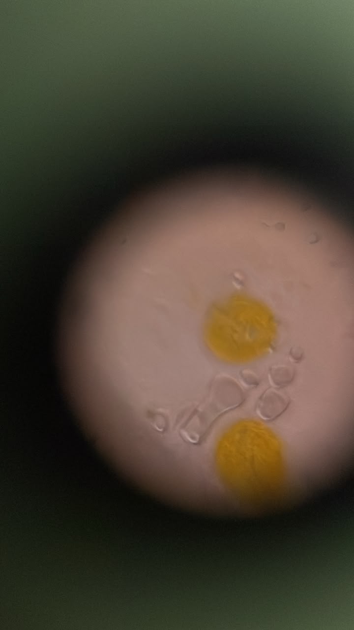 post_media%2FSmmivcJrPTRikVTUxyxxV7lcSbw2%2Fnopid%2F42oo9s0q92_Pollen1140x4.jpeg?alt=media&token=7cac2c25-2e18-4c32-a04d-f2e62d2ad449