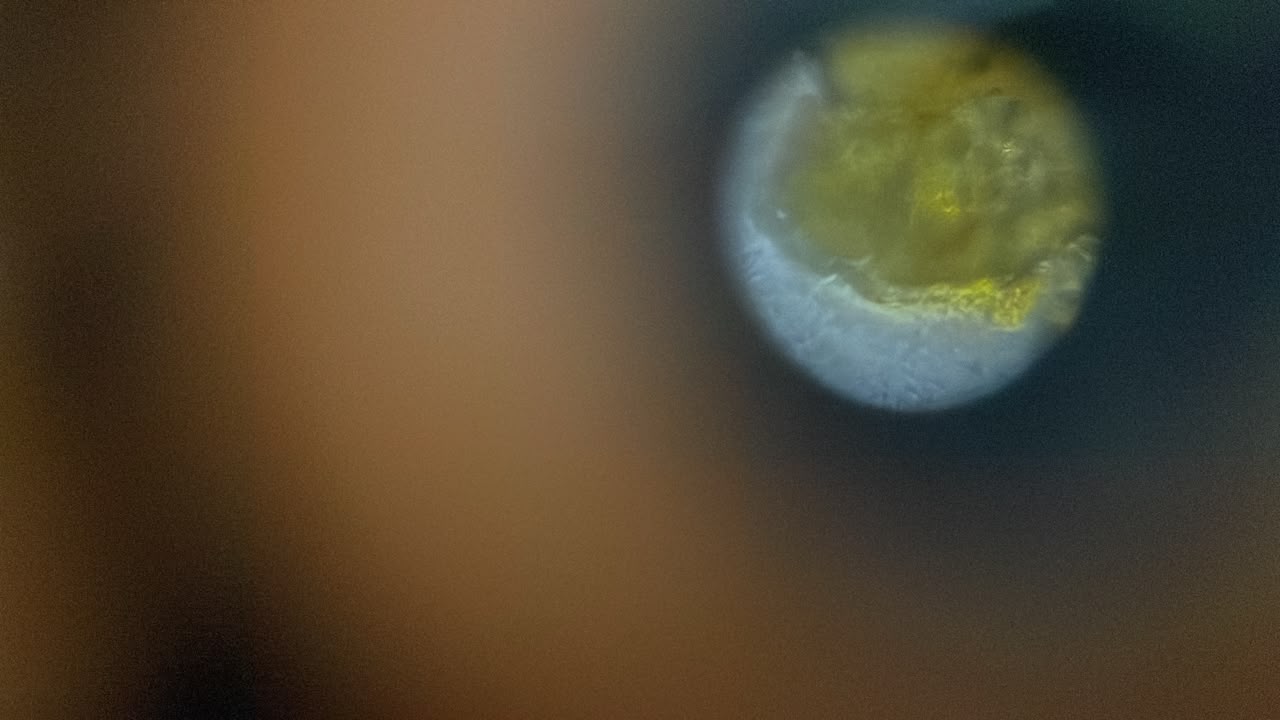 post_media%2FSmmivcJrPTRikVTUxyxxV7lcSbw2%2Fnopid%2Fjgzcpzkixf_Pollen1340x2.jpeg?alt=media&token=8d60b10a-e00f-4a66-9eb7-74892007b248