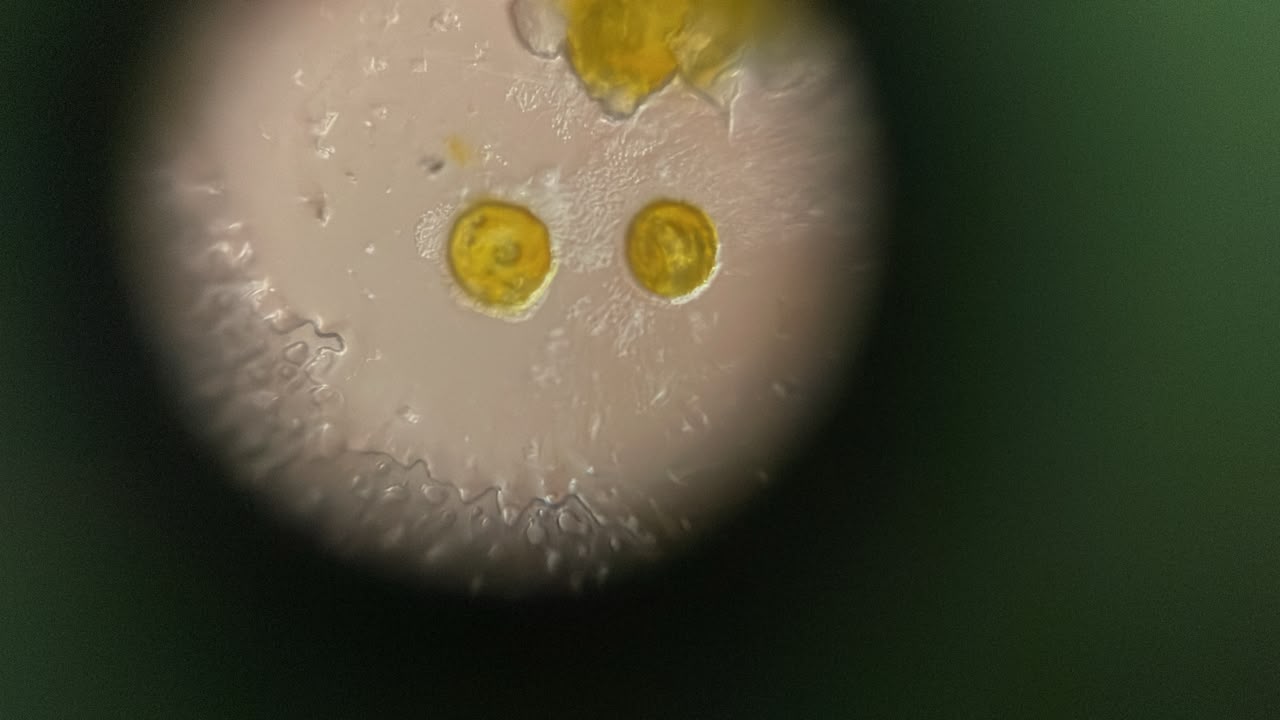 post_media%2FSmmivcJrPTRikVTUxyxxV7lcSbw2%2Fnopid%2Fr8ccv16ckx_Pollen1140x3.jpeg?alt=media&token=cd6c3bfc-9664-41b9-a738-44f8685c67a1