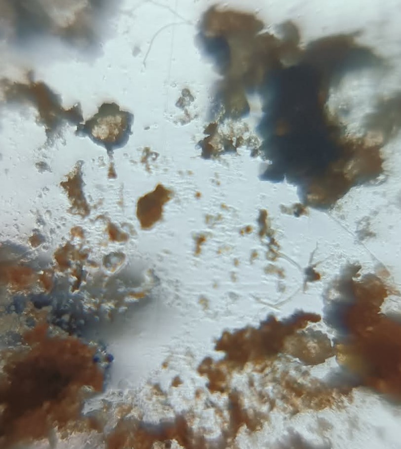 post_media%2FT5D1yLajbUdE27pDdHOVp4HRgpB2%2Fnopid%2F1sz51e7yyt_Spider%20copy.jpg?alt=media&token=ffd95b3d-8204-4e23-be73-a02455f0336f