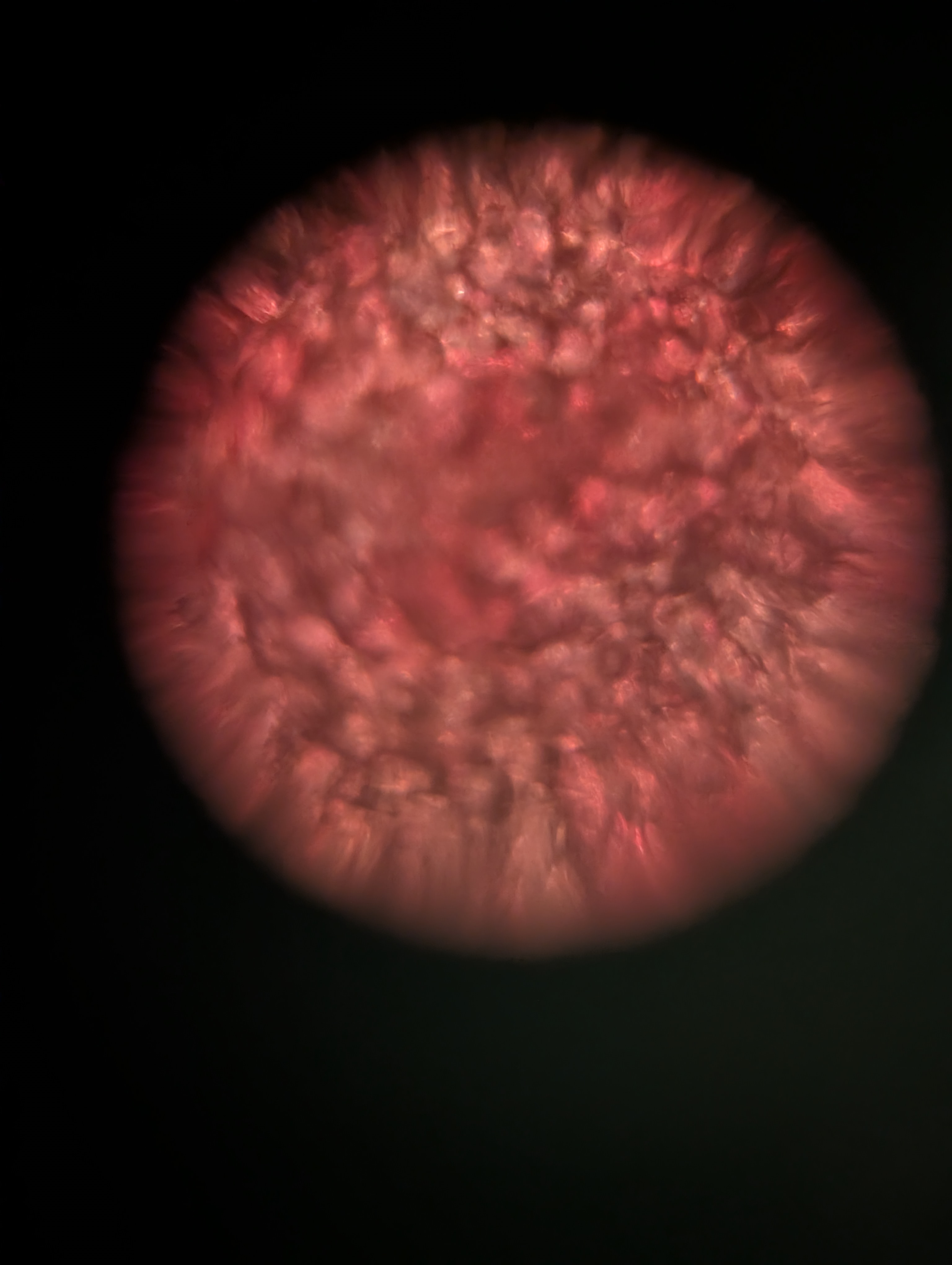 post_media%2FWqSZEF9HZGeECaexMRgfOGU6Aaa2%2Fnopid%2Fdwrdfi3her_1000023767.jpg?alt=media&token=377fa6b4-910a-41b9-90ac-1cd63552bd49