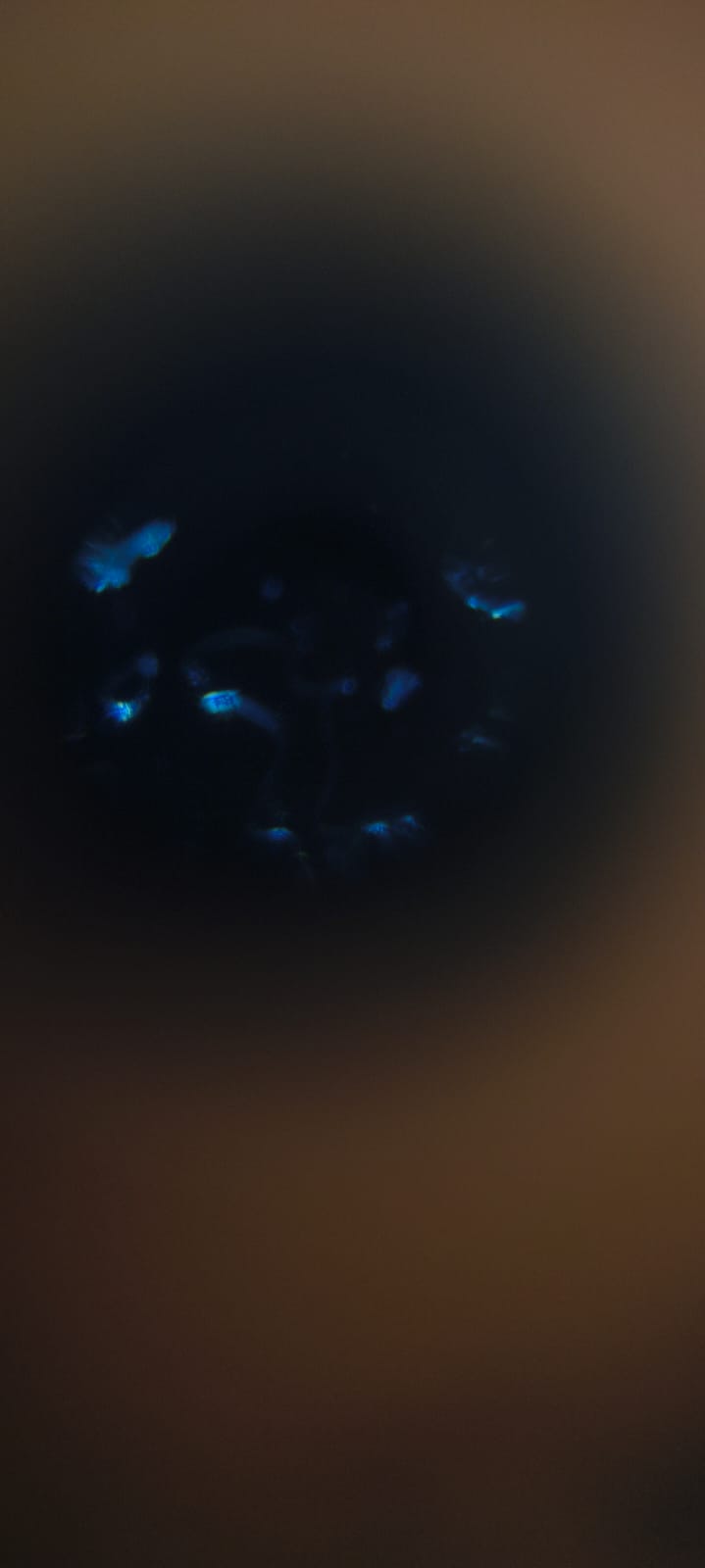 post_media%2FbW3hZEn4H2gUseabtoipMHq5wtW2%2Fnopid%2Fote9rdjh9c_Pollen%20dark%20field.jpeg?alt=media&token=7e1b18b1-0f13-47f5-906e-81cdc9c10847