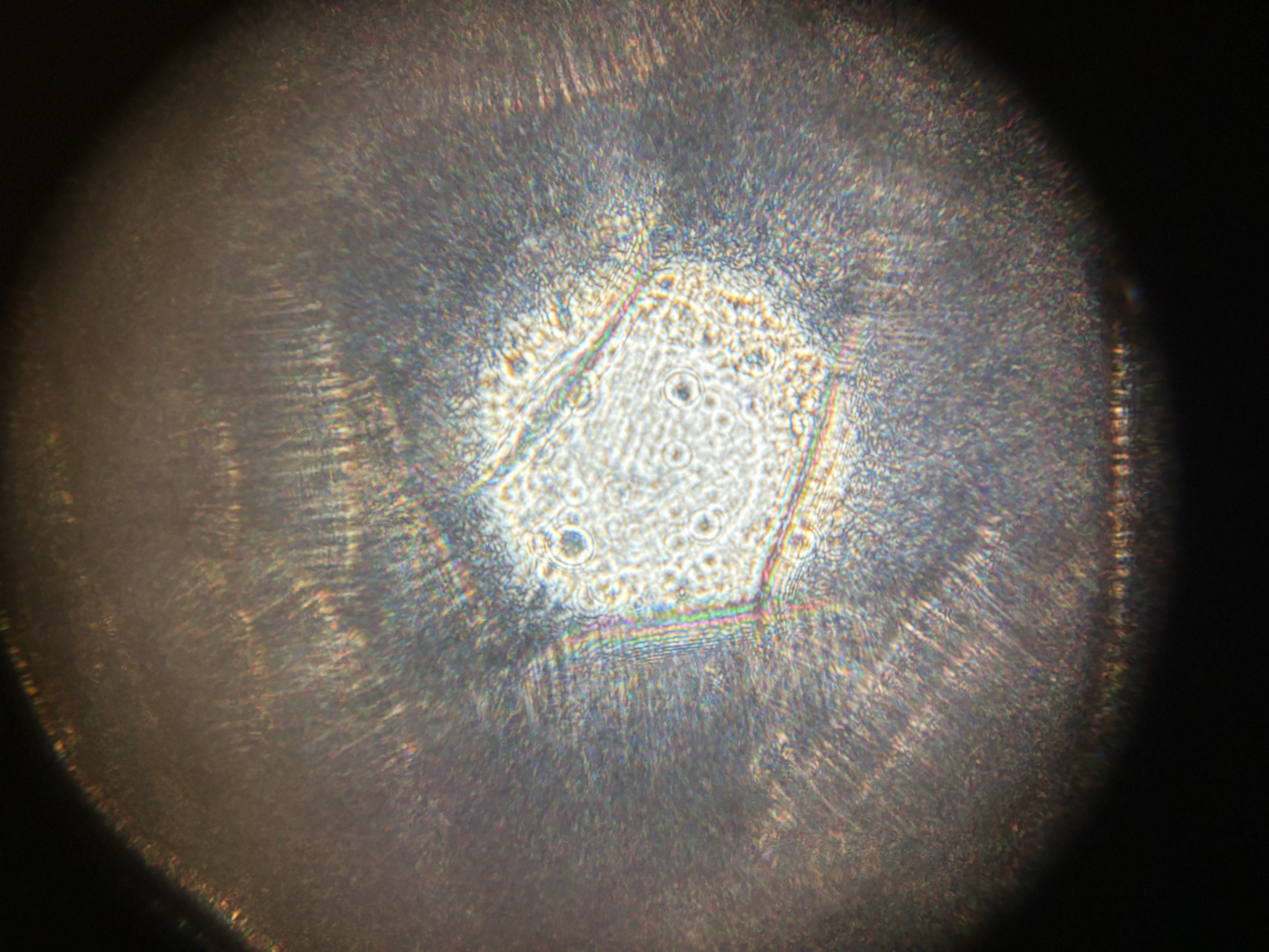 post_media%2FellwEdPdwJVCLeMETfXcGGETgnr1%2Fnopid%2F3i1r92d1zc_tempImage7JDX1C.jpg?alt=media&token=87adfc3d-497f-454b-87e7-44d9cc068d25