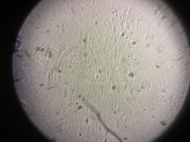 post_media%2FfCx1IPY2NBSiTsOenENycTFETKW2%2FSoNgoKpPGgdP80xaWhm8%2F8xv6lcj9ur_IMG_9543.jpeg?alt=media&token=6927aaad-6286-40c0-af15-171d66247238