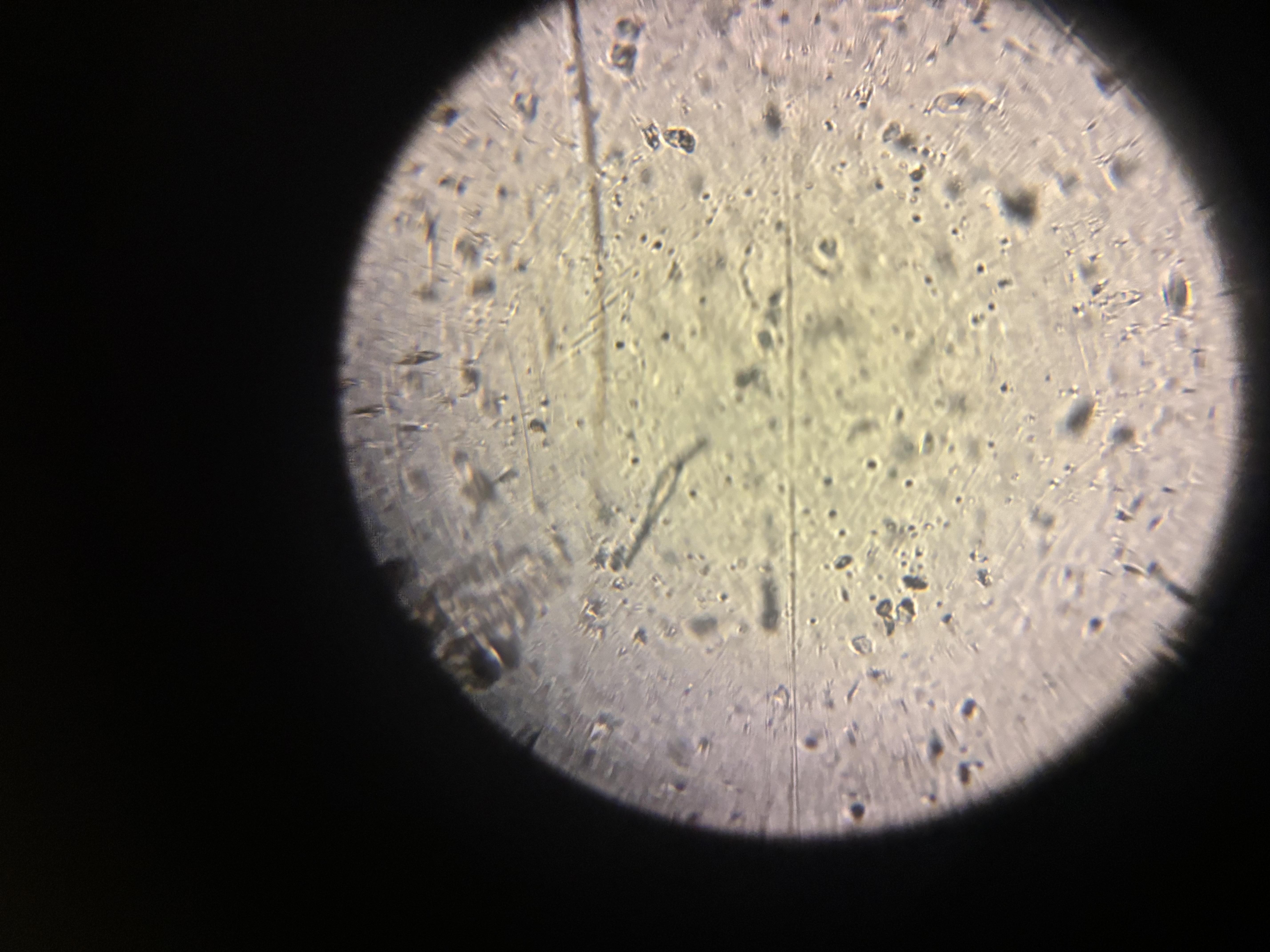 post_media%2FfCx1IPY2NBSiTsOenENycTFETKW2%2FSoNgoKpPGgdP80xaWhm8%2Fj5etcqlkmj_IMG_9524.jpeg?alt=media&token=7add633f-f0d3-48d8-9863-4bb57abb6549