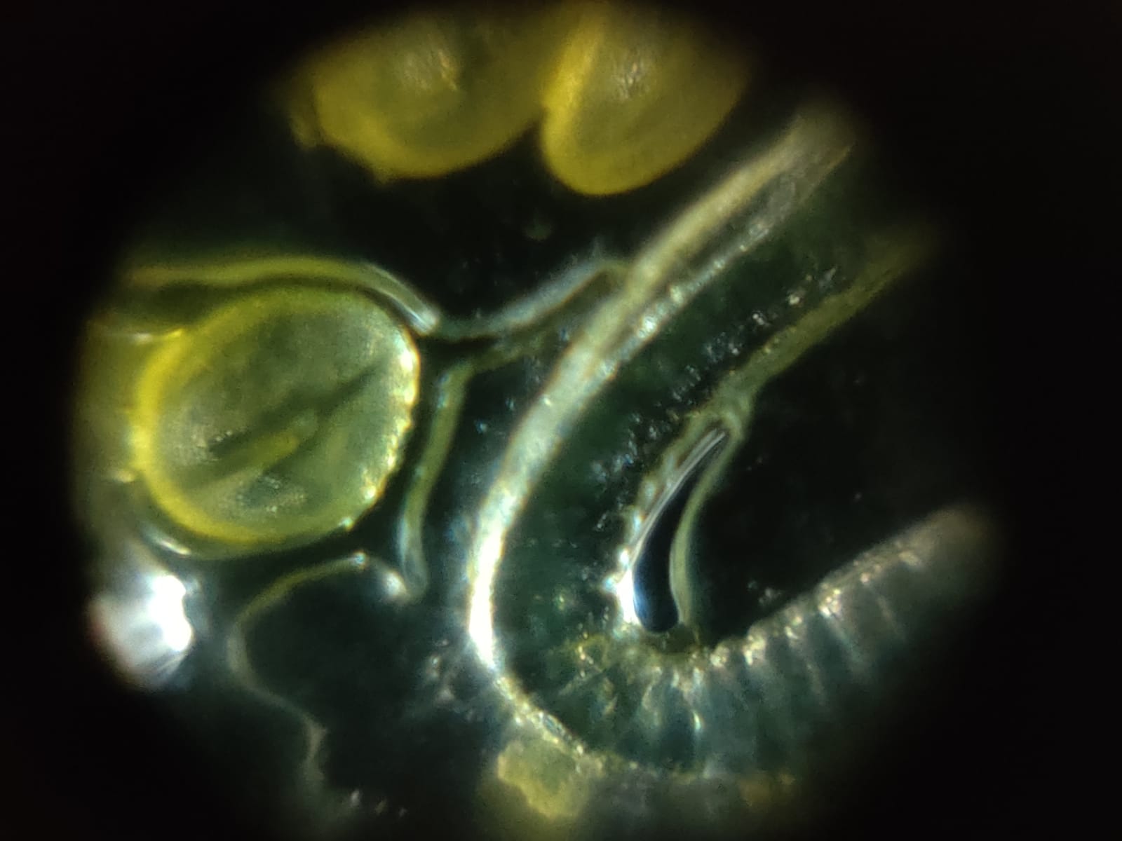 post_media%2Fj9pDSFJtJTWm2PbKKqi3uJxOHh13%2Fnopid%2Fedn8h0d08s_Pumpkin%20Seed%20Dark%20Microscopy.jpeg?alt=media&token=9d276478-1ebc-47dd-9f4a-3ddfe253718f