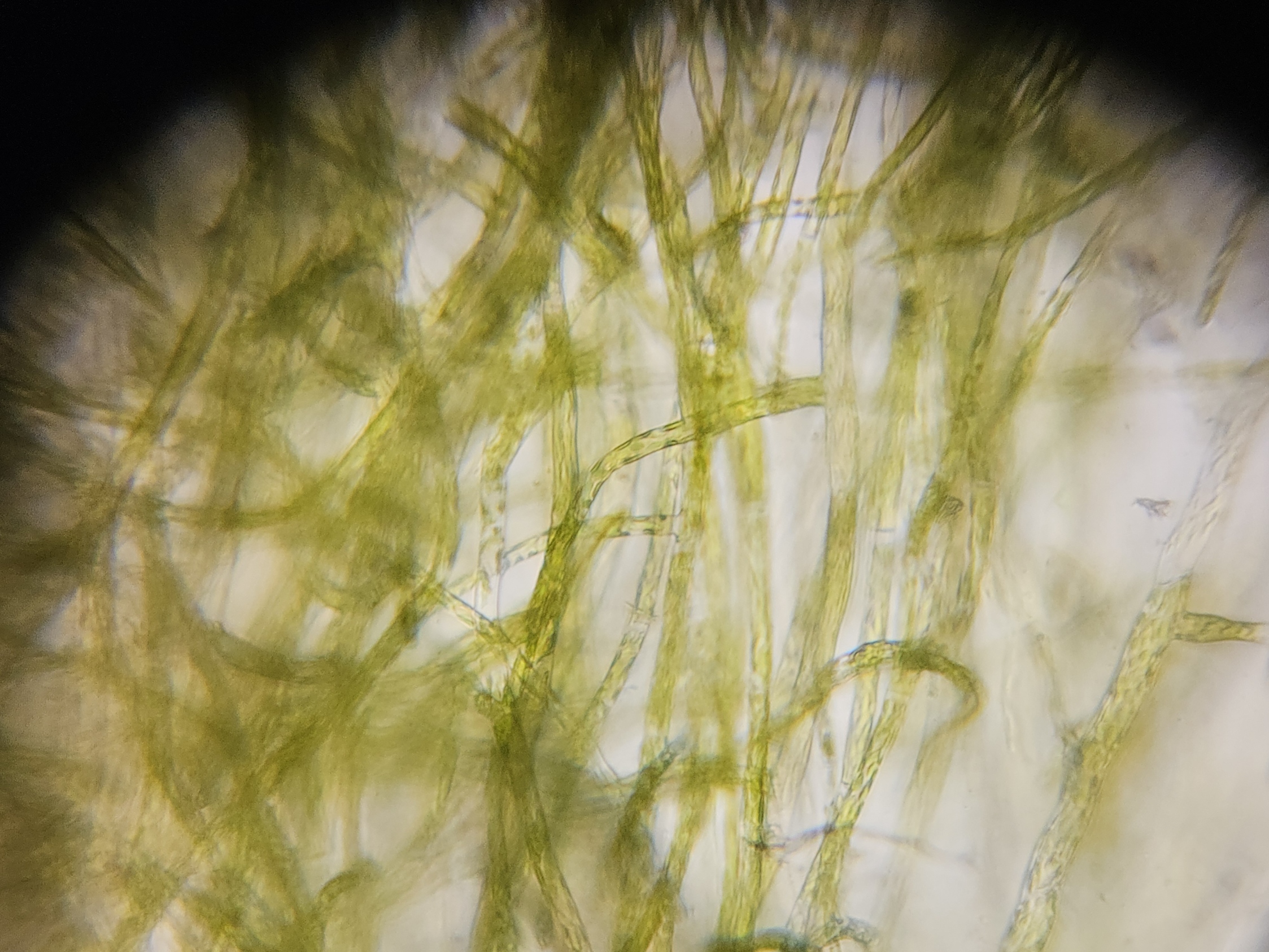 post_media%2FtPyHFkx5VFWSzEnh8dzRukf8rCK2%2Fnopid%2Fknwxvv2j6y_Foldscope%20-%20Algae_Rhizocolonium.jpg?alt=media&token=353df511-9f3c-445d-9c83-bf32aa7f1a42