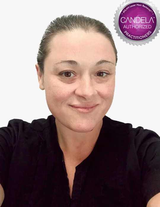 Adele T., employee at Milan Laser Hair Removal in Niagara Falls