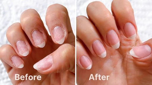 why-nail-services-create-a-vulnerable-environment