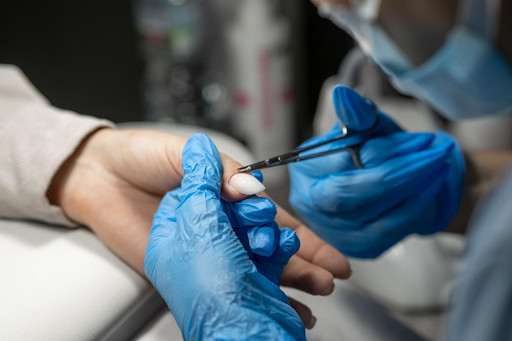 how-skilled-preparation-protects-the-nail-plate