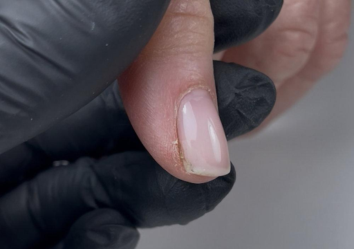 skin-contact-and-curing-stability