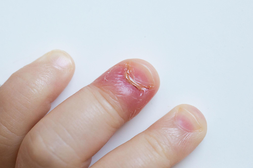 why-nail-services-create-a-vulnerable-environment