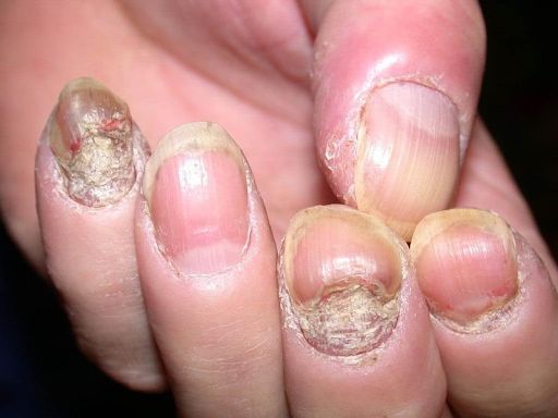 why-nail-services-create-a-vulnerable-environment