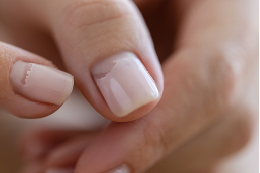 close-up of gel polish peeling from the nail due to adhesion issues