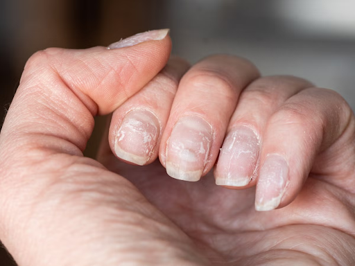 close-up of thin or damaged natural nails that struggle to hold gel products