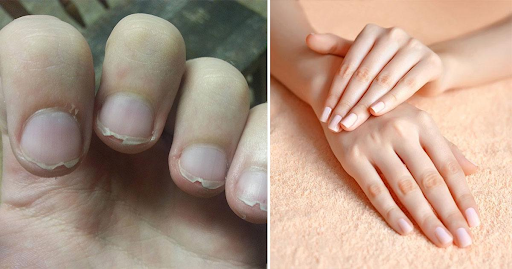 why-overprocessing-can-compromise-nail-health