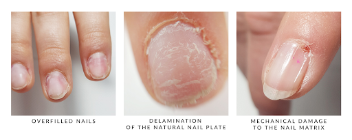 comparison of different natural nail conditions affecting product performance