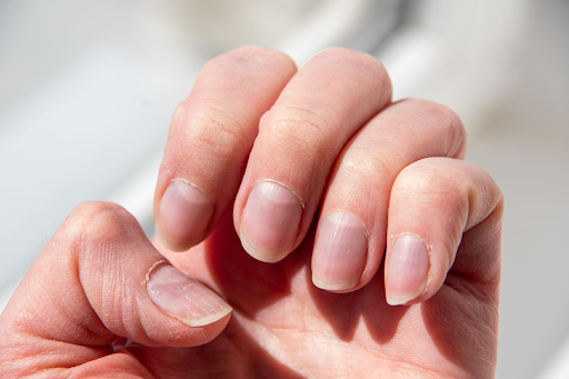 adaptation-to-different-nail-conditions