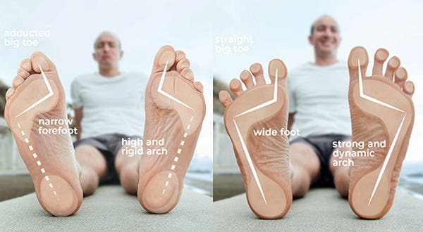 Barefoot Shoes: Are They Right For You?