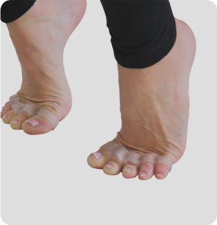 toe spacers | toe separators | barefoot shoes | minimalist shoes