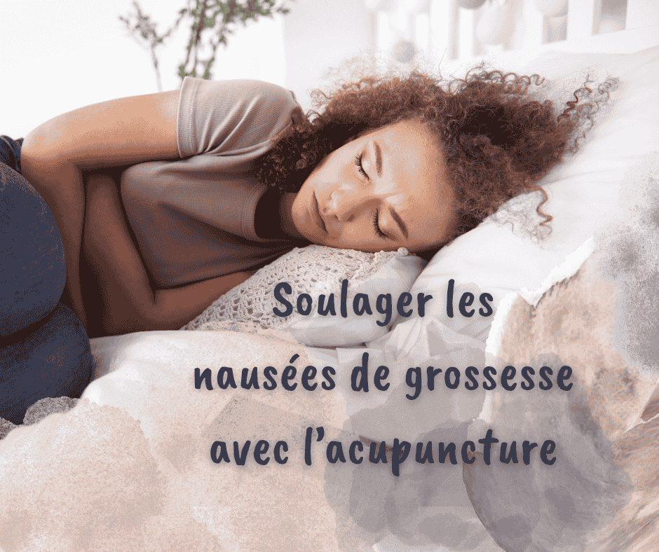 L’acupuncture pour les nausées de grossesse : un soulagement naturel au premier trimestre