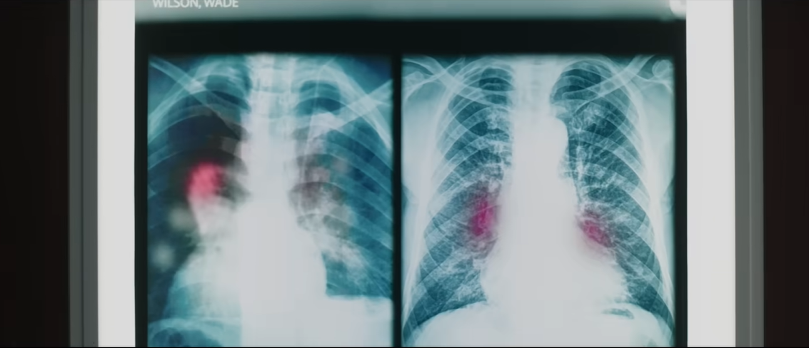 Deadpool (2016) Review: Breaking the Fourth Wall, and a Few Skulls