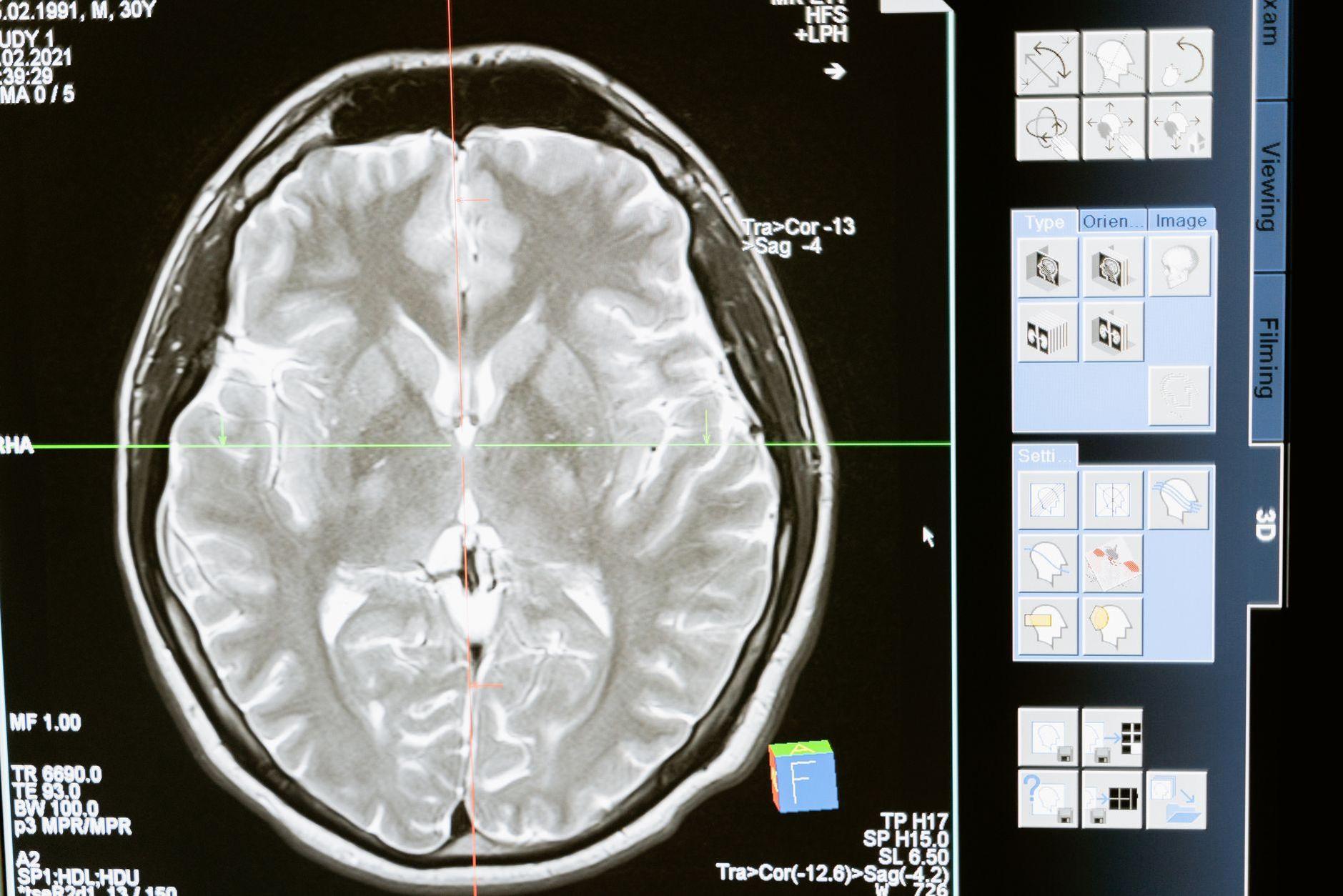 General visual reference for Differential Diagnosis. Source: Pexels / Photo by MART PRODUCTION / Pexels License / https://www.pexels.com/photo/technology-computer-head-health-7089020/